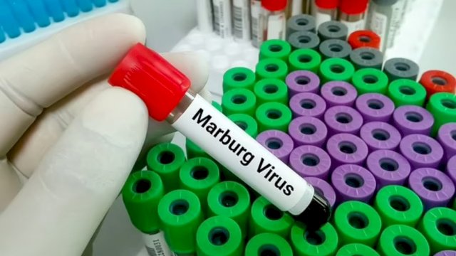 Virus Marburg Mirip Ebola Ditemukan di Afrika Barat