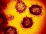 Kemenkes Terbitkan Edaran Kewaspadaan Terhadap Virus Nipah