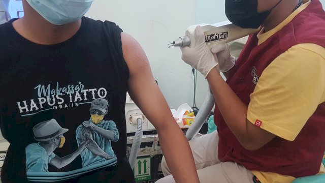 Dokumentasi kegiatan hapus tatto gratis yang dilaksanakan Yayasan Mahtan beberapa waktu lalu. 