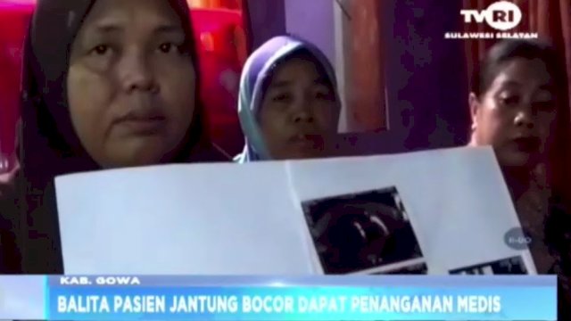 Gubernur Andi Sudirman Bantu Balita di Gowa yang Bocor Jantung Sejak 3 Tahun Lalu