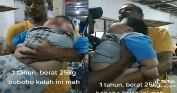 Viral Bayi Usia 1 Tahun Beratnya 25 Kg, Bikin Netizen Khawatir