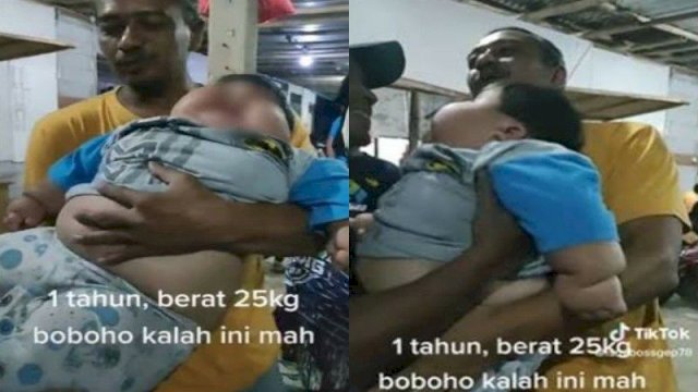 Viral Bayi Usia 1 Tahun Beratnya 25 Kg, Bikin Netizen Khawatir