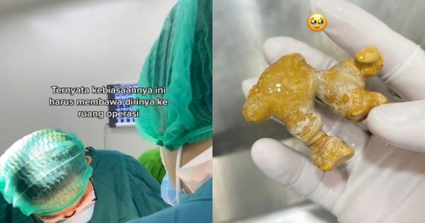 Viral Pasien dengan Batu Ginjal Sebesar Jahe, Ternyata Ini Penyebabnya