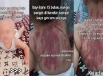 Viral Bayi 13 Bulan Dikerok Pakai Koin oleh Baby Sitternya Hingga Punggung Memerah 