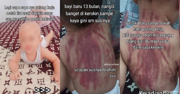 Viral Bayi 13 Bulan Dikerok Pakai Koin oleh Baby Sitternya Hingga Punggung Memerah 