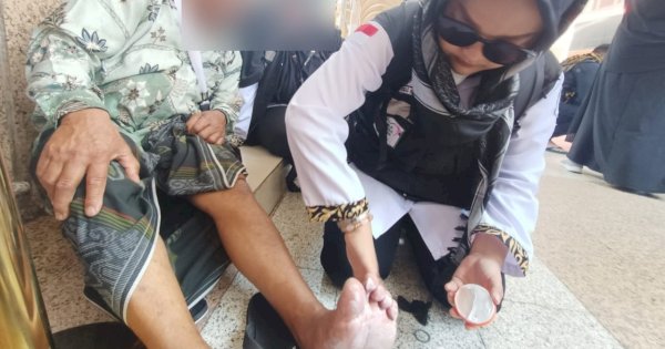 Cuaca Panas di Madinah, Kaki Jenaah Haji Melepuh 