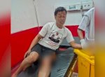 Cicipi Bubuk Putih, Granat Latihan Meledak di Tangan Tukang Ojek di Garut