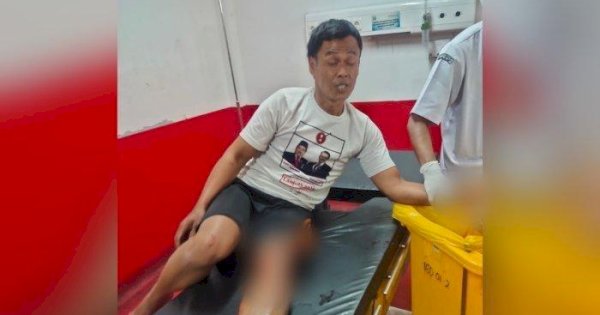 Cicipi Bubuk Putih, Granat Latihan Meledak di Tangan Tukang Ojek di Garut