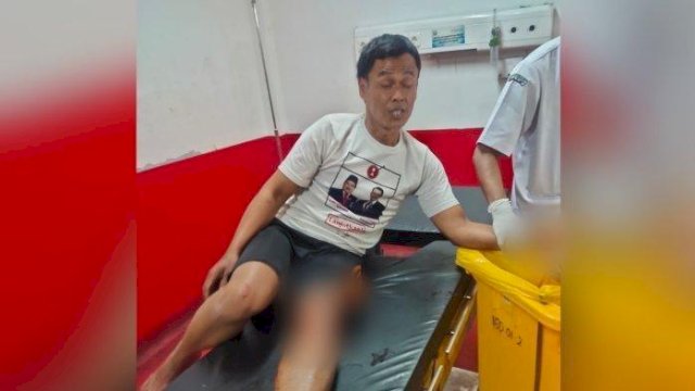 Cicipi Bubuk Putih, Granat Latihan Meledak di Tangan Tukang Ojek di Garut