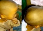 Viral Siswi Menangis Dibotakin Guru Tanpa Izin Orang Tua Gegara Banyak Kutu 