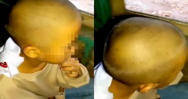 Viral Siswi Menangis Dibotakin Guru Tanpa Izin Orang Tua Gegara Banyak Kutu 