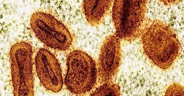 143 Anak-anak di Kongo Meninggal Misterius dalam Waktu 15 Hari