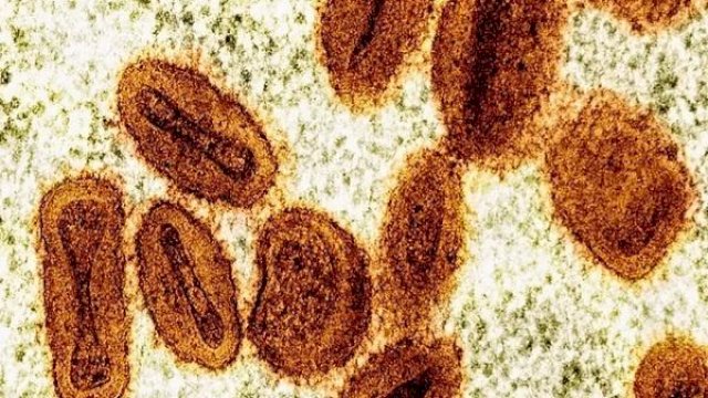 143 Anak-anak di Kongo Meninggal Misterius dalam Waktu 15 Hari