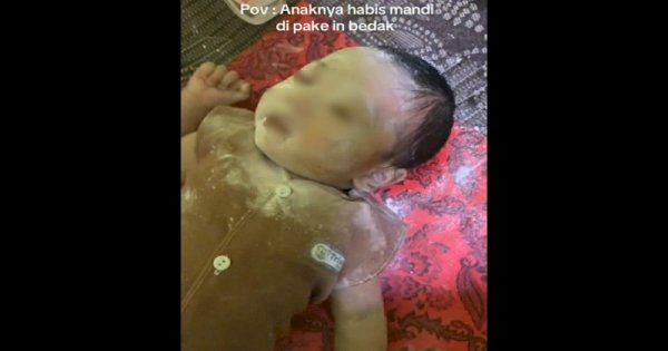 Viral Bayi Diberi Bedak Tabur Berlebihan di Wajah hingga Bersin-bersin 