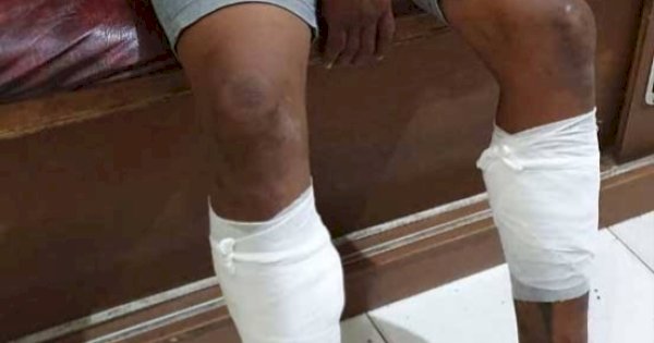 Mencoba Kabur Saat Pengembangan, Begal di Makassar Dapat Hadiah Timah Panas 